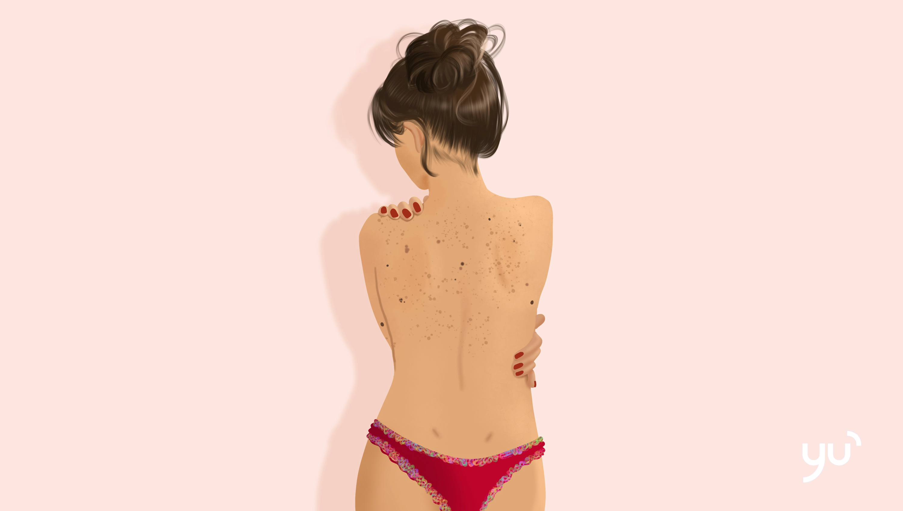 Les différents types de grains de beauté expliqués