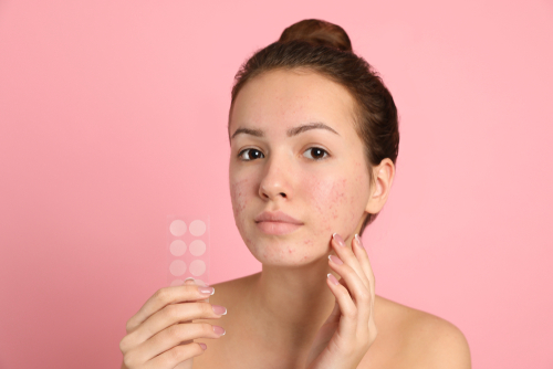 Les patchs anti-boutons sont-ils efficaces ?