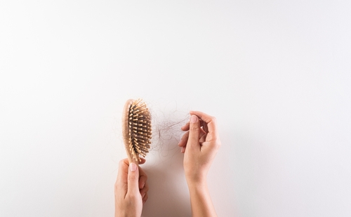 Perte de cheveux et SOPK : comprendre les liens et les facteurs sous-jacents