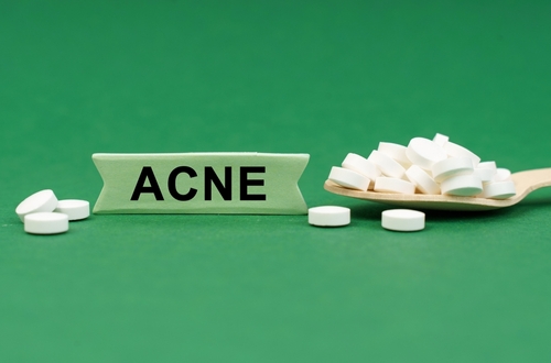 Traitements topiques contre l’acné : guide pratique