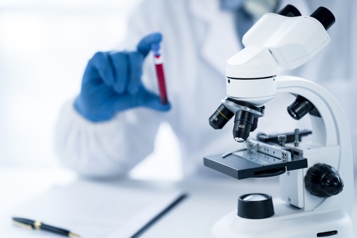 L’hormone anti-müllérienne : un indicateur clé pour le diagnostic du SOPK
