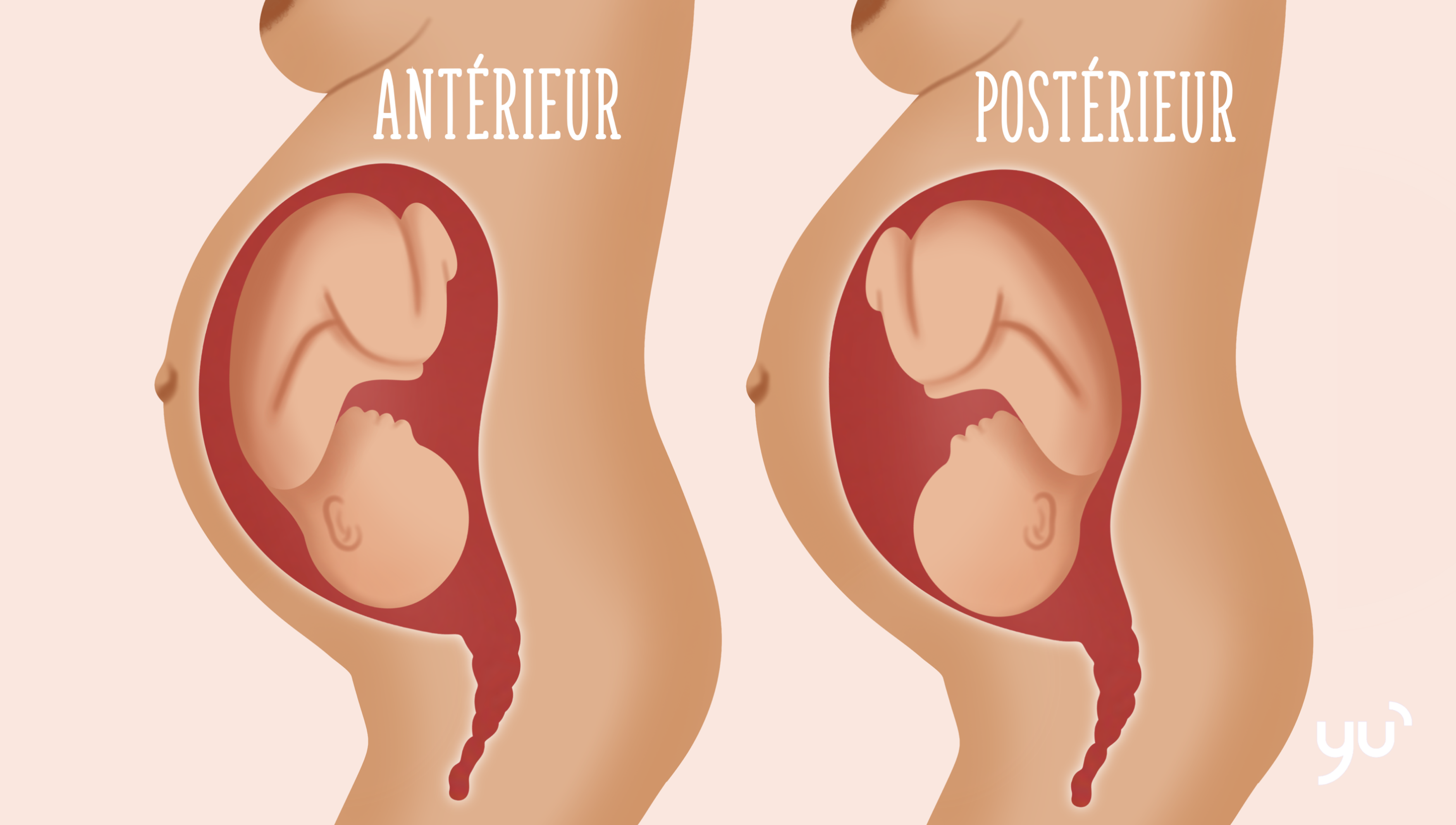 Bébé en position postérieure : ce que vous devez savoir