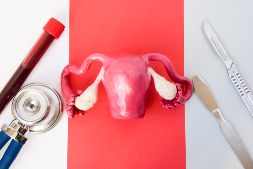 Vivre avec des fibromes utérins : conseils et options de traitement