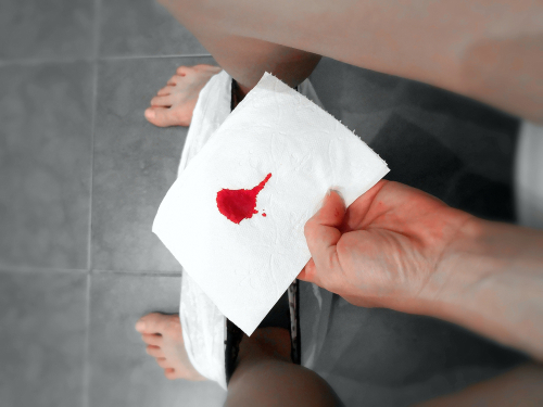 Suis-je en train de vivre une fausse couche ?