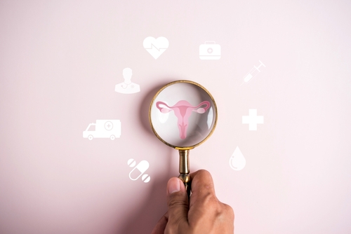 Traitement chirurgical du SOPK : options et indications