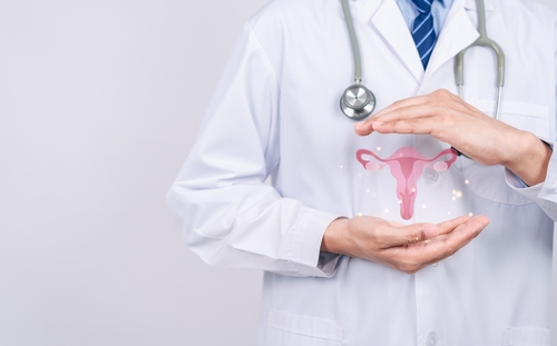Les tests complémentaires dans le diagnostic du Syndrome des Ovaires Polykystiques (SOPK)