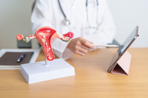 Les meilleurs traitements pour l’obstruction des trompes de Fallope