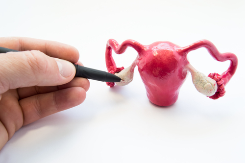 Comment l’inflammation des trompes de Fallope peut affecter la conception ?