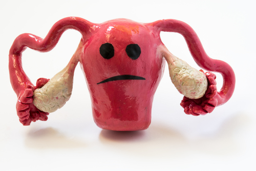 Mythes et réalités : les fibromes utérins sont-ils dangereux ?