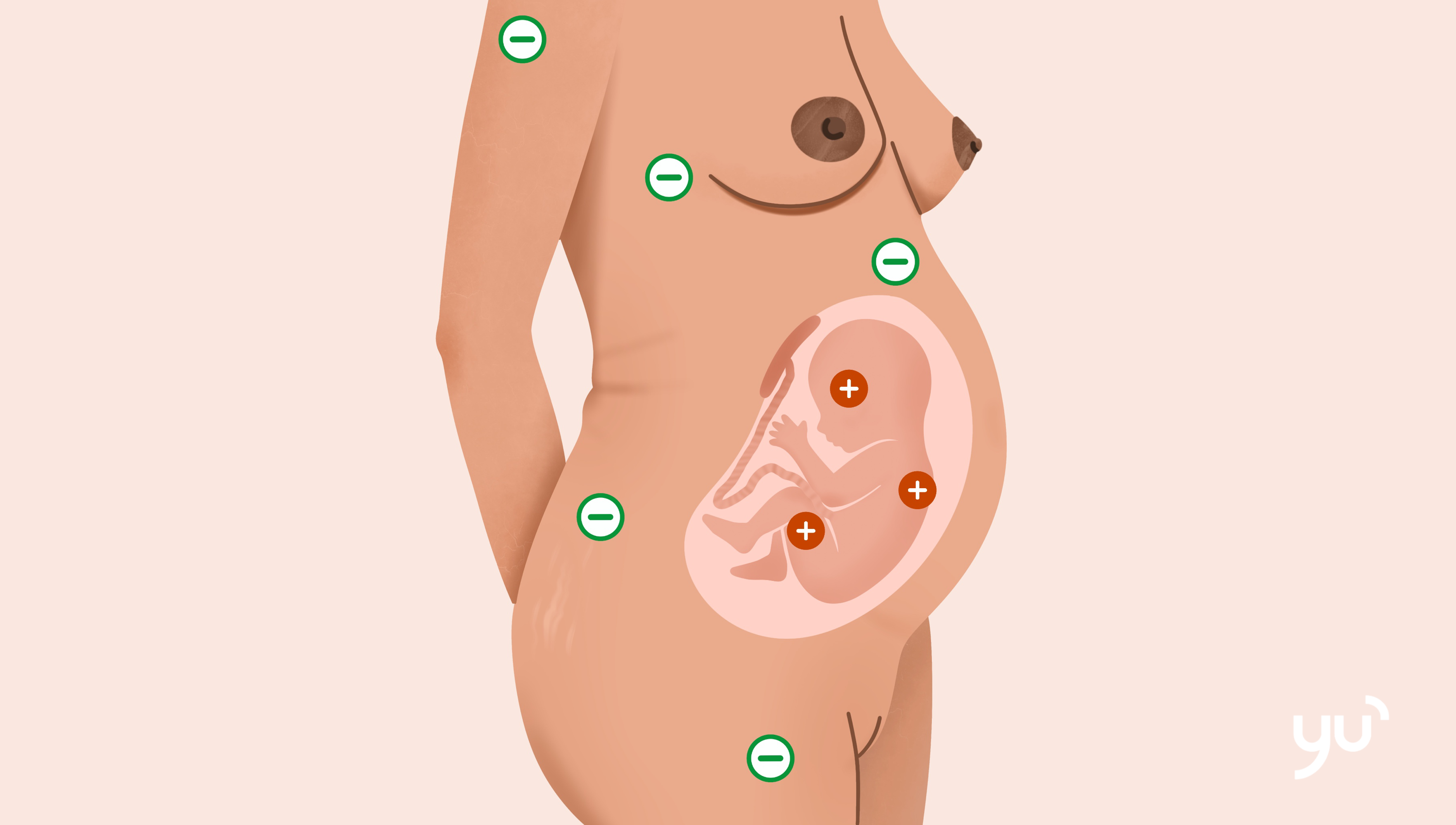 Qu’est-ce que l’incompatibilité Rh et quand est-elle un problème ?