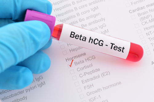 À quel point le test de l’hormone bêta hCG est-il fiable ?